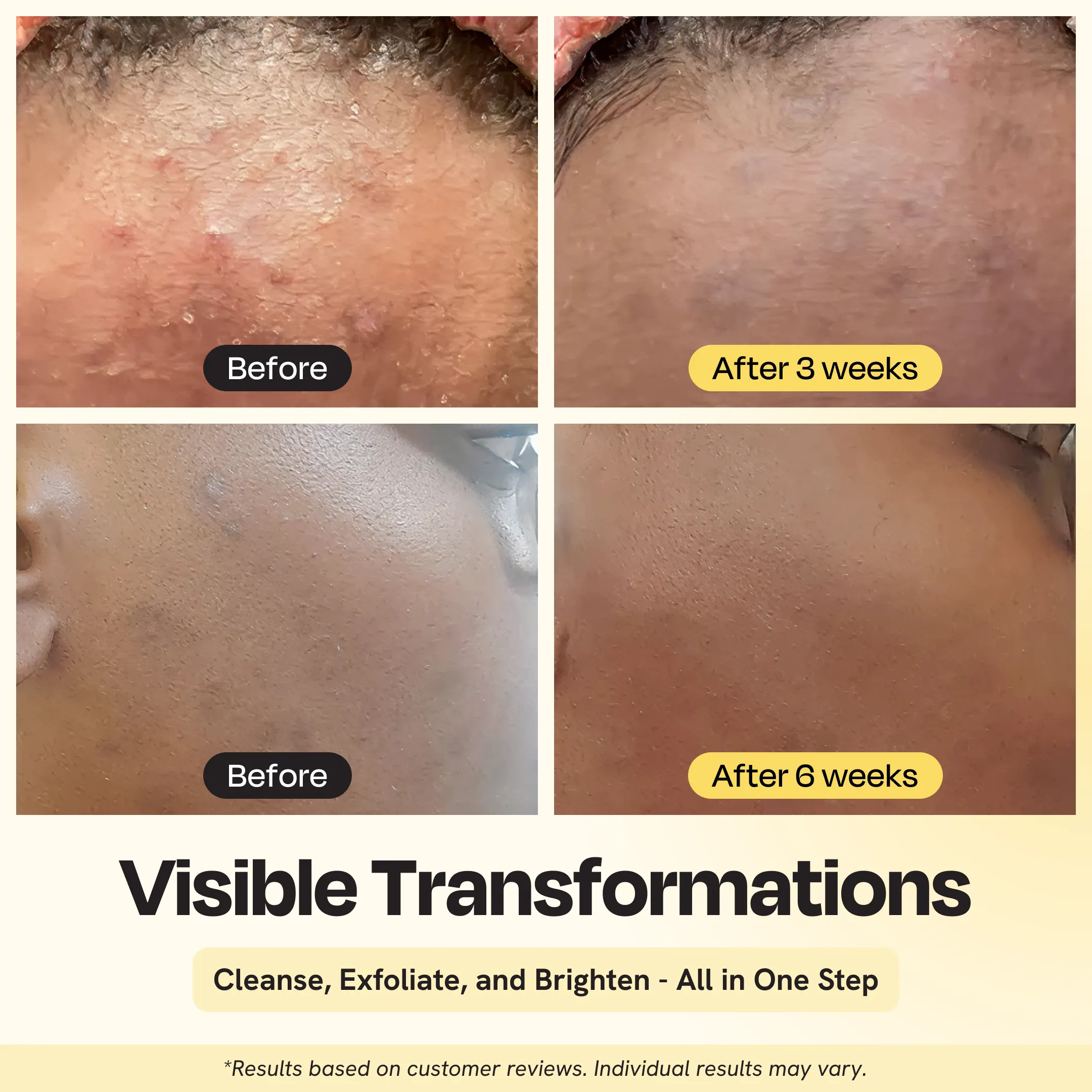 Clarifying Brightening Cleanser - Image 5