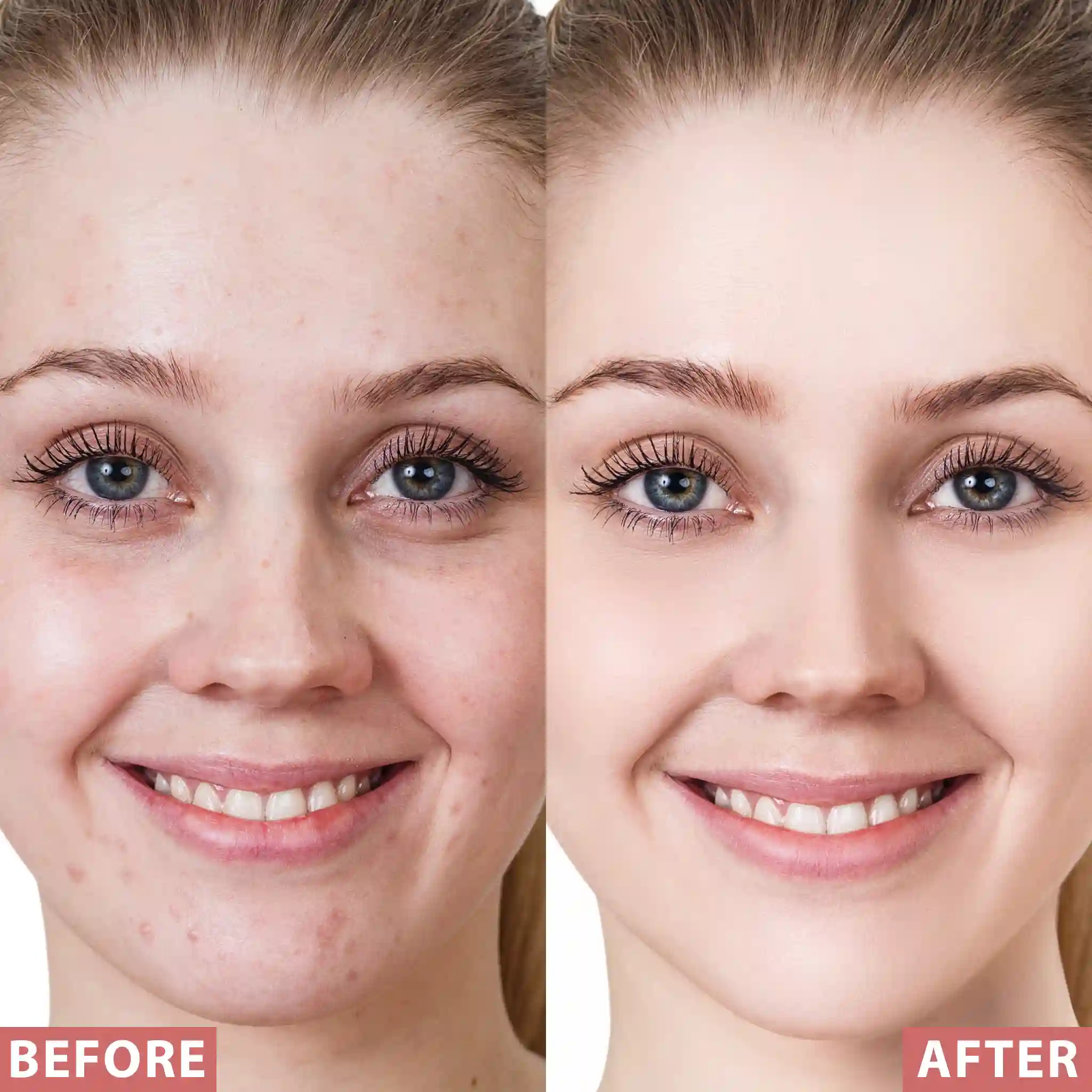 All-in-One BB Cream - Image 9